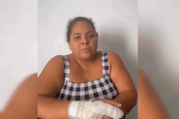 Nara Rayane sofre amputação após falha em maca